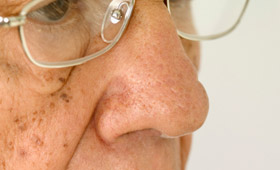 Geriatricarea manchas seniles Eucerín hiperpigmentación