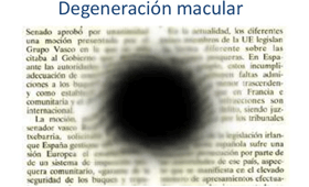 Geriatricarea degeneración macular Grupo Oftalmológico Tres Torres