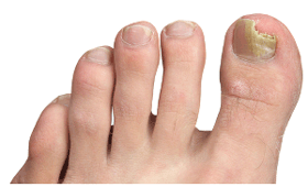 geriatricarea curso pie diabético eSaludate