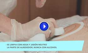 Geriatricarea ostomía vídeo Sanyres
