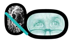 geriatricarea envejecimiento ocular ICQO