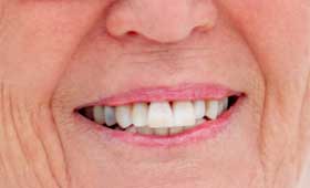 geriatricarea salud bucodental Sanyres