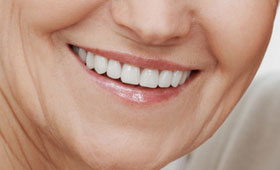 geriatricarea prótesis dentales 3D Procoven