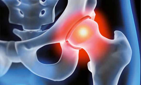 geriatricarea osteoporosis Sociedad Española de Medicina Interna