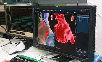 ecografía abdominal