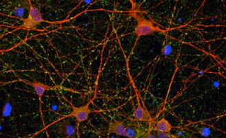 geriatricarea ictus nitrona RP19