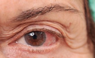 geriatricarea enfermedade de la retina