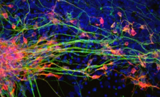 geriatricarea proteína RAC1 procesos neurodegenerativos Parkinson