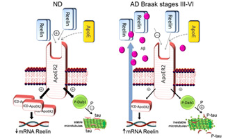 geriatricarea Reelina alzheimer