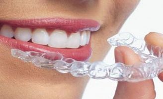 geriatricarea ortodoncia invisible