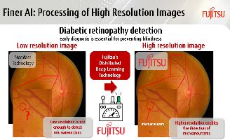 geriatricarea retinopatia diabetica