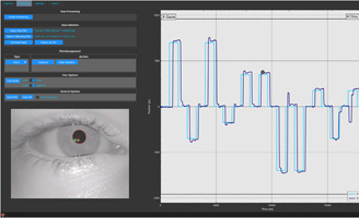 geriatricarea enfermedades neurodegenerativas movimientos oculares