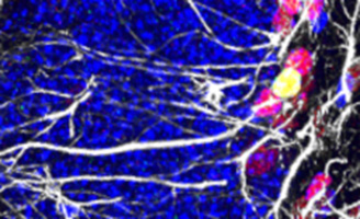 geriatricarea células madre