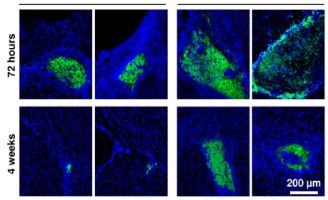 geriatricarea biomaterial