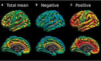 geriatricarea enfermedad de Alzheimer