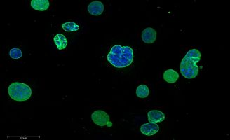 geriatricarea envejecimiento acelerado