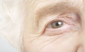 geriatricarea degeneracion macular