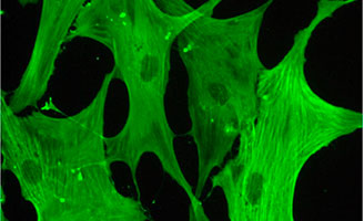 geriatricarea estenosis aórtica