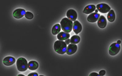 geriatricarea envejecimiento prematuro celulas madre