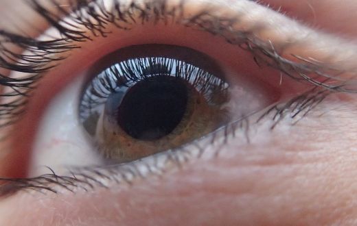 geriatricarea lente intraocular
