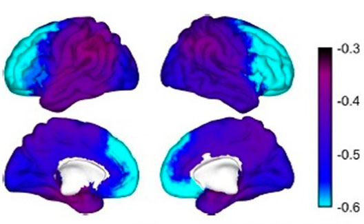 geriatricarea alzheimer