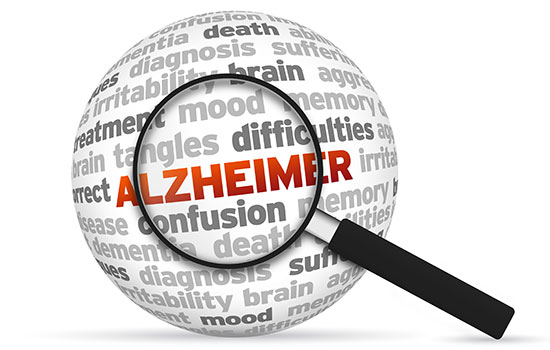 geriatricarea alzheimer valdecilla