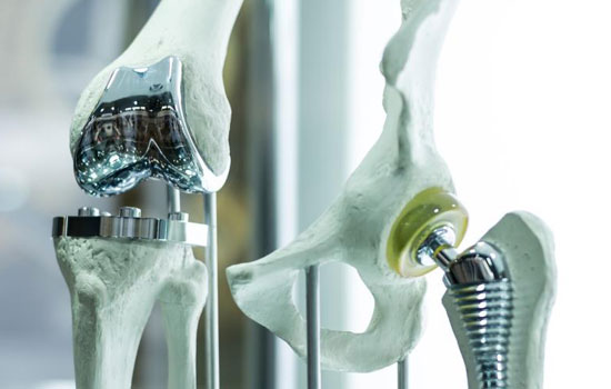 geriatricarea protesis de cadera