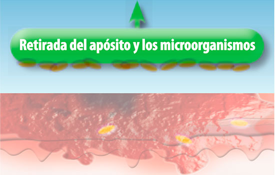 geriatricarea antimicrobianos Cutimed Sorbact