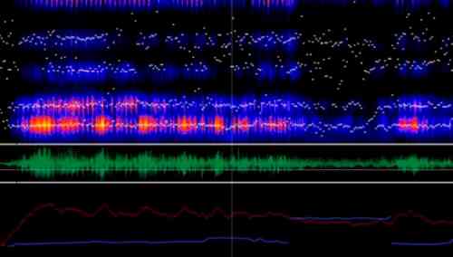 geriatricarea Parkinson voz