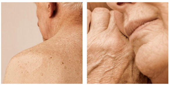 geriatricarea piel personas mayores