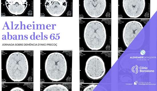 geriatricarea Alzheimer Catalunya demencias inicio precoz