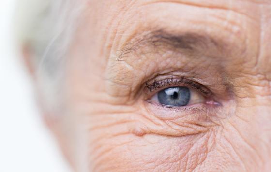 Geriatricarea- deficiencia de vitamina D, enfermedades oculares, estrés oxidativo, salud ocular