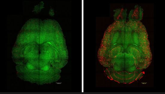 geriatricarea alzheimer IBEC