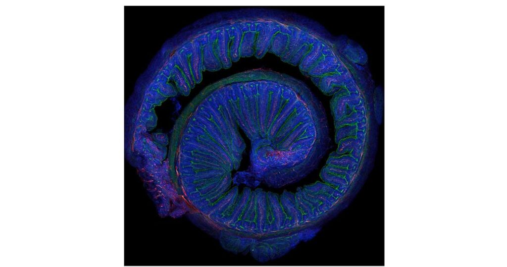geriatricarea microbiota plasticidad cerebral