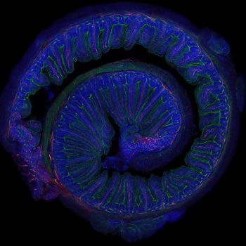 geriatricarea microbiota