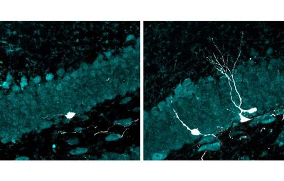 Geriatricarea- Alzheimer estimulación con luz y sonido, CONICET