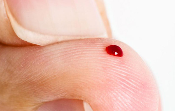 Geriatricarea, Alzheimer, muestra de sangre