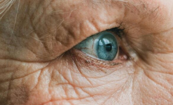 geriatricarea alzheimer retina