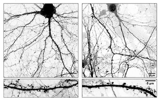 geriatricarea L-Dopa