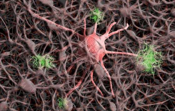 Geriatricarea- proteína PRKCG, diana para investigar tratamientos contra el Alzheimer