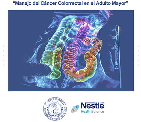 geriatricarea Cancer Colorrectal SEGG