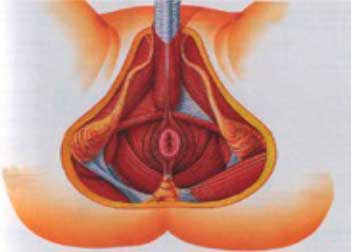 geriatricarea estrenimiento impactacion fecal