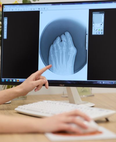 geriatricarea pies sanos podologia
