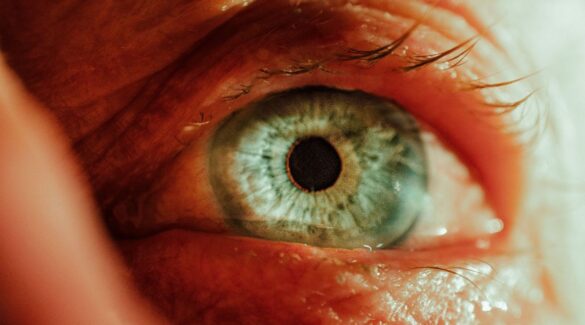 geriatricarea retina alzheimer