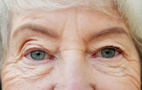 Geriatricarea- patologia ocular