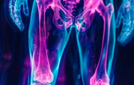 geriatricarea Fracturas por Fragilidad
